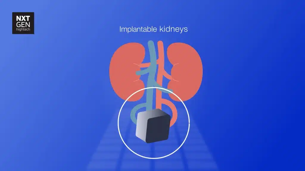 Hightechnl nierstichtingnederland 2d animatie phil en flo 5 - High Tech NL - Nierstichting Nederland -  - Phil & Flo Creative Studio